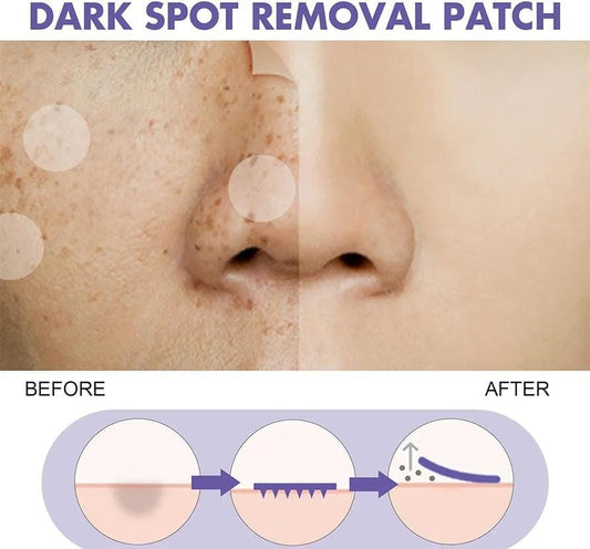 Parches Anti-Imperfecciones EELHOE – Dark Spot Removal Patch