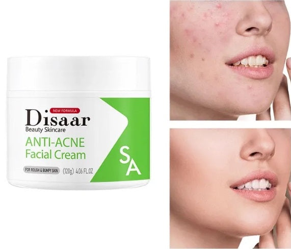 SET ANTI-ACNÉ 3 EN 1 - Jabón Facial, Suero Facial, Crema Facial