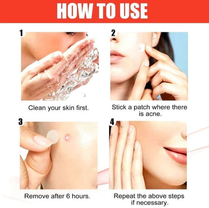Parches Anti-Imperfecciones EELHOE – Dark Spot Removal Patch