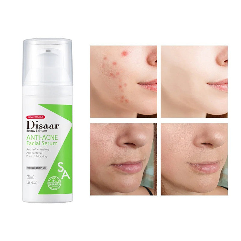 SET ANTI-ACNÉ 3 EN 1 - Jabón Facial, Suero Facial, Crema Facial