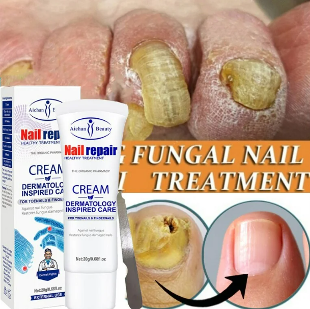 Crema Reparadora de Uñas Antihongos