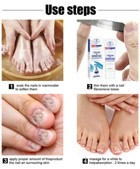Crema Reparadora de Uñas Antihongos