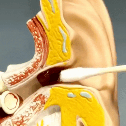 SMART SWAB – LIMPIADOR DE OÍDOS (Kit Completo 16ps)