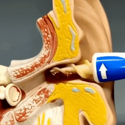 SMART SWAB – LIMPIADOR DE OÍDOS (Kit Completo 16ps)