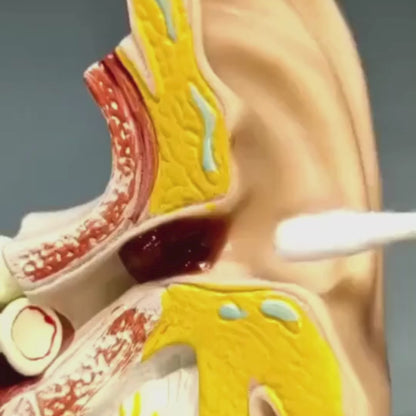 SMART SWAB – LIMPIADOR DE OÍDOS (Kit Completo 16ps)